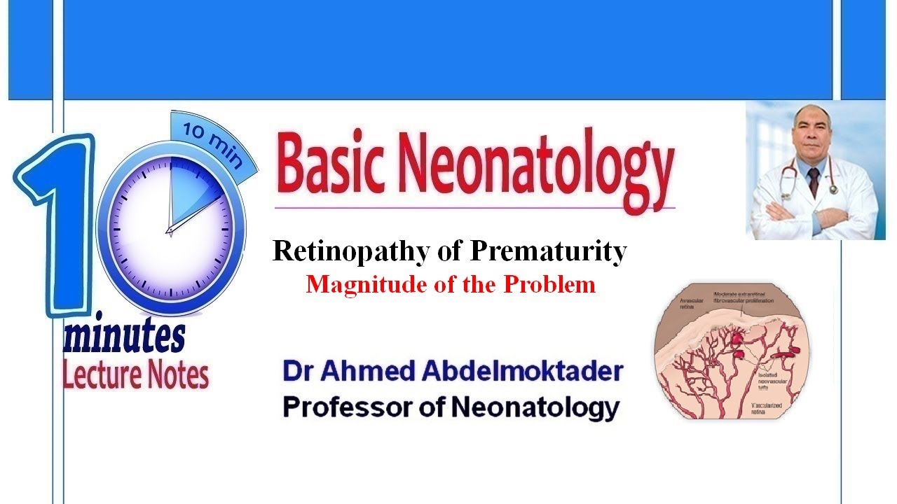 Retinopathy Of Prematurity