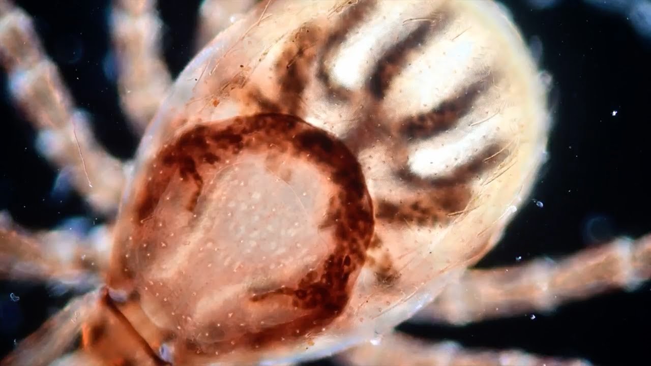 Sabías que as carrachas poden causar unha chea de enfermidades?