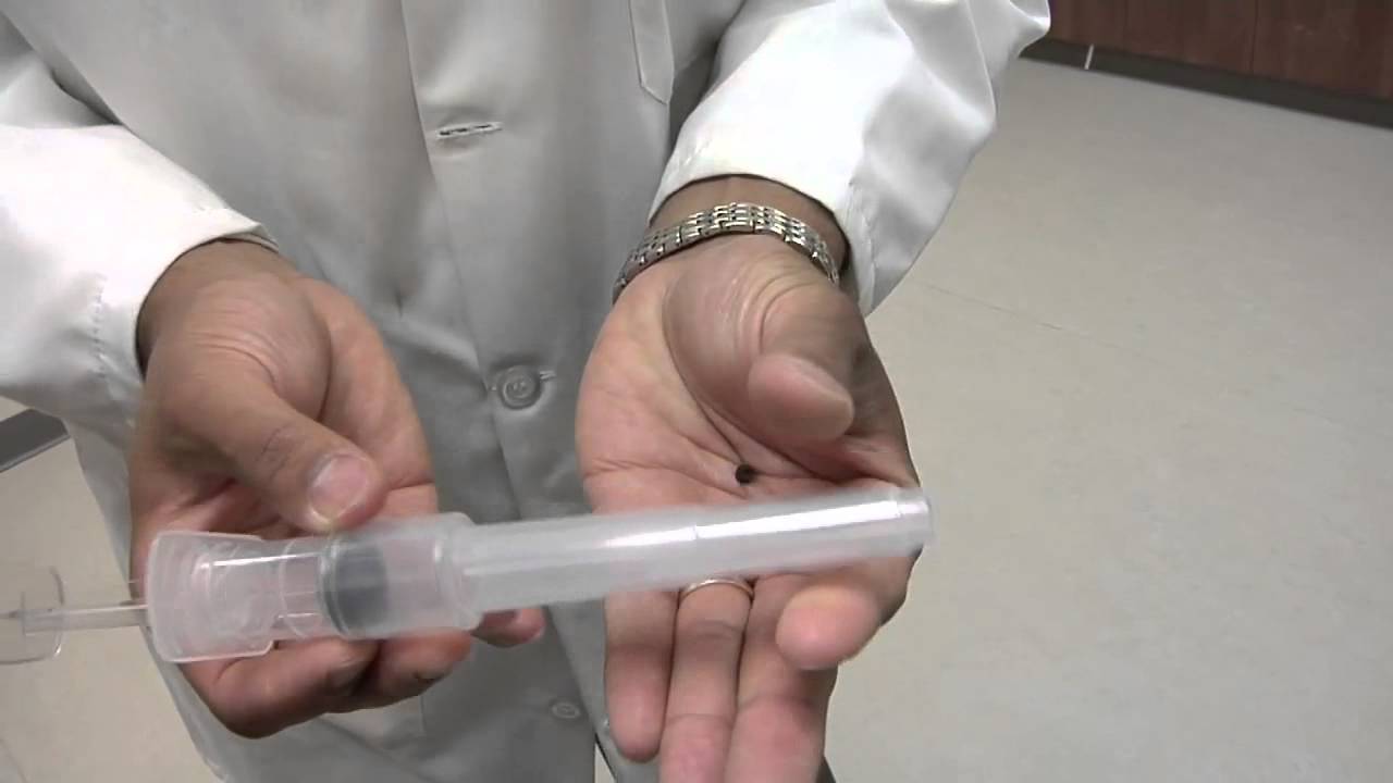 Banding for Hemorrhoids | Reading HealthBreak