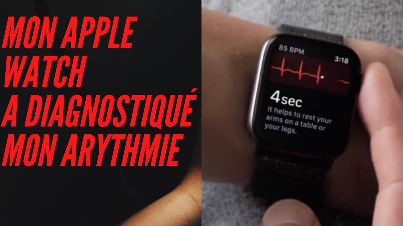 Montres connectées : mythe ou réalité en cardiologie ?