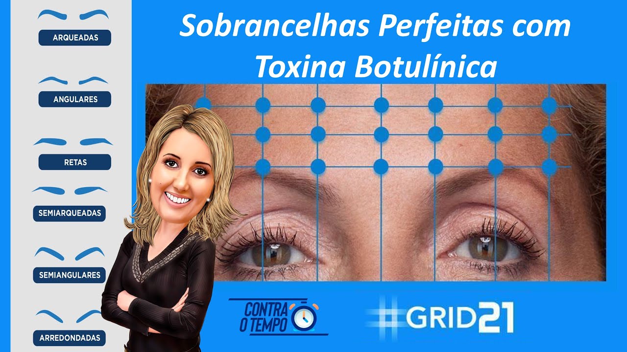 Sobrancelha perfeita com nova técnica de aplicação de toxina botulínica na testa - Grid 21