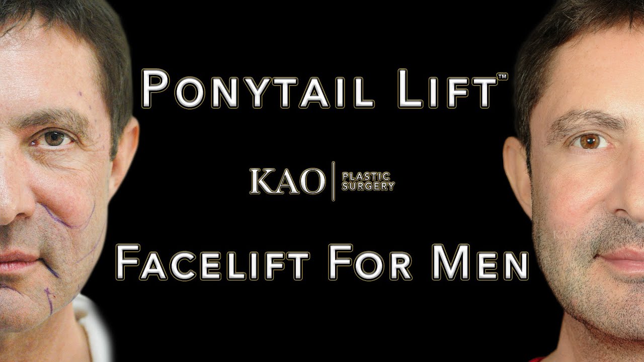 Можно ли мужчинам делать подтяжку лица? Kao Plastic Surgery