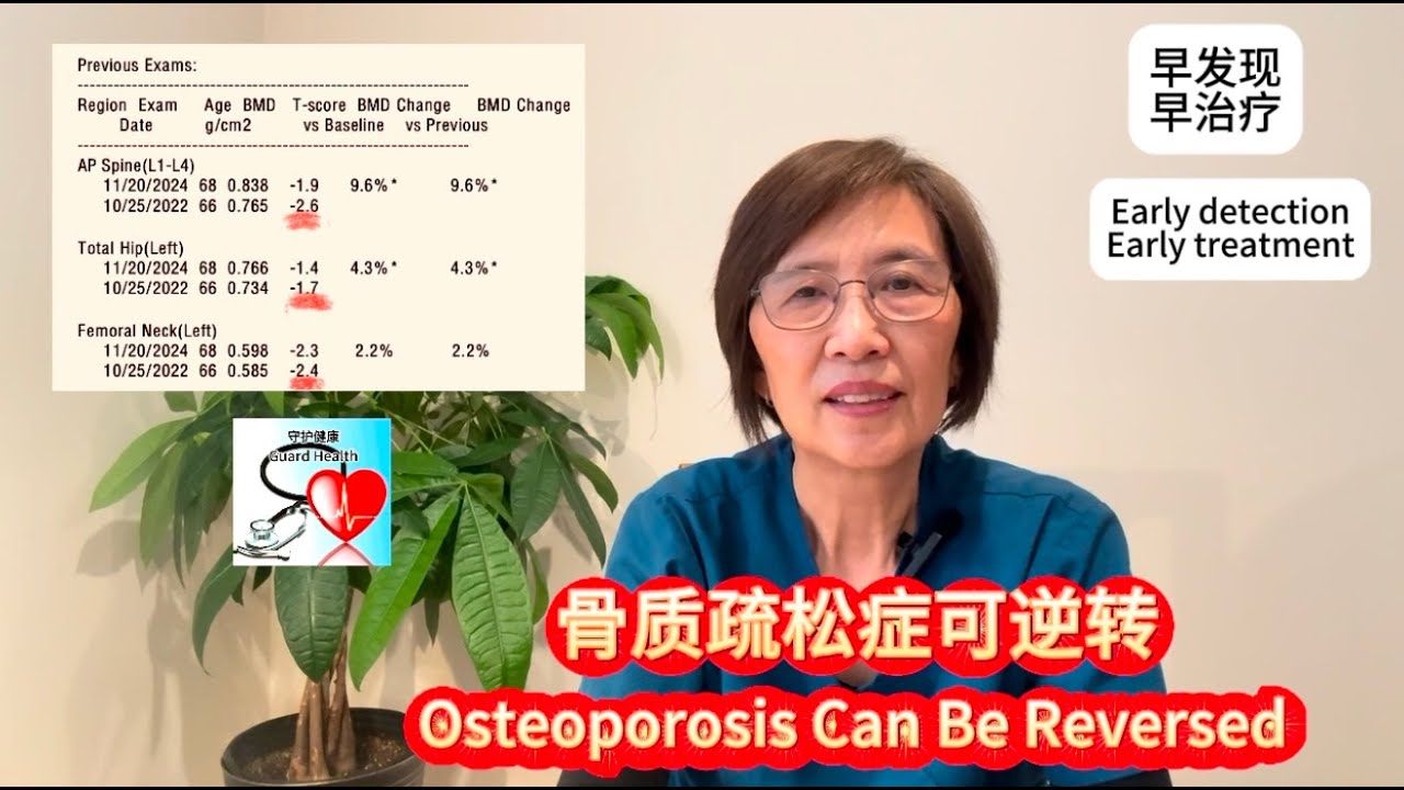 骨质疏松症可逆转 Osteoporosis Can Be Reversed 中老年医疗保健系列短视频 (43)