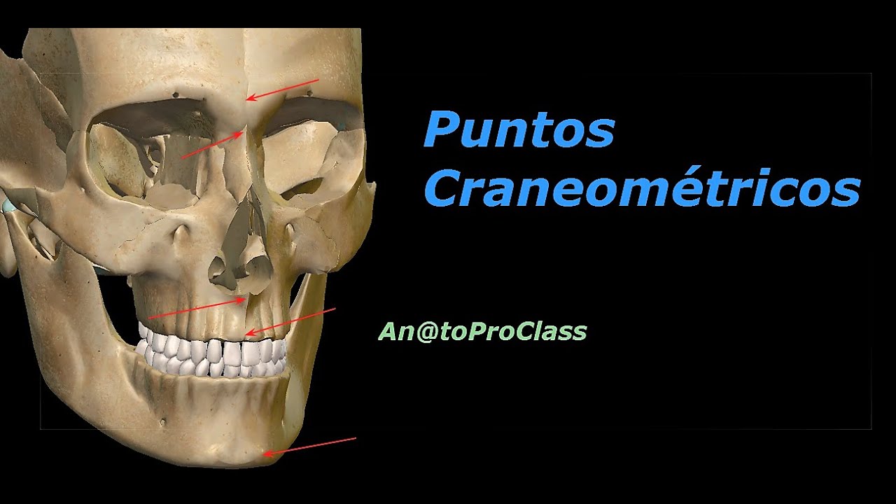 Puntos craneométricos