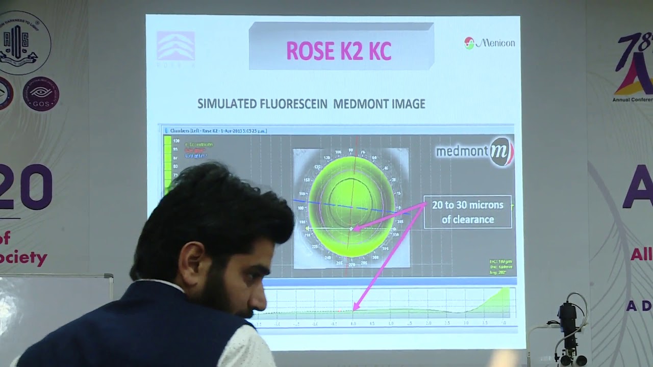 AIOC2020 GP162 T1 Dr  Paul Rose Lecture on ‘Fitting Techniques of Rose K Lenses