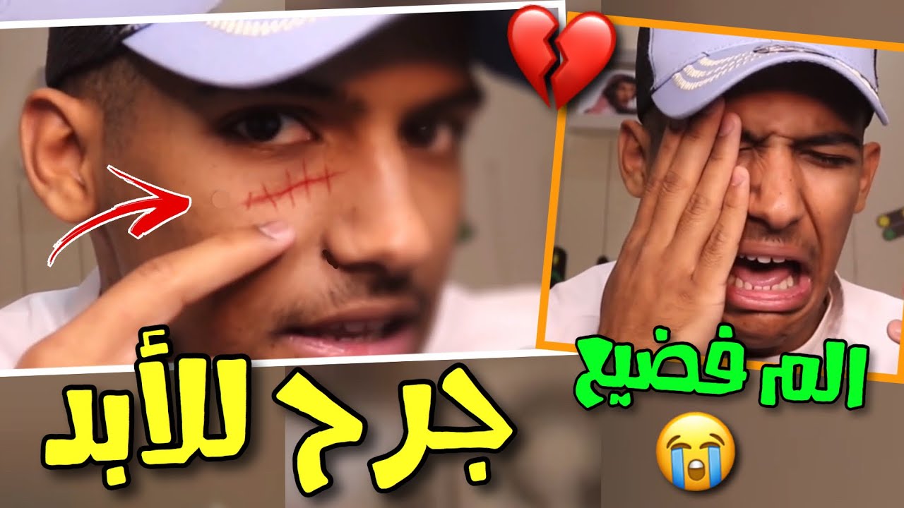 تسببت في جرح لنفسي راح يضل للأبد💔😭(الحمدلله على كل حال)-