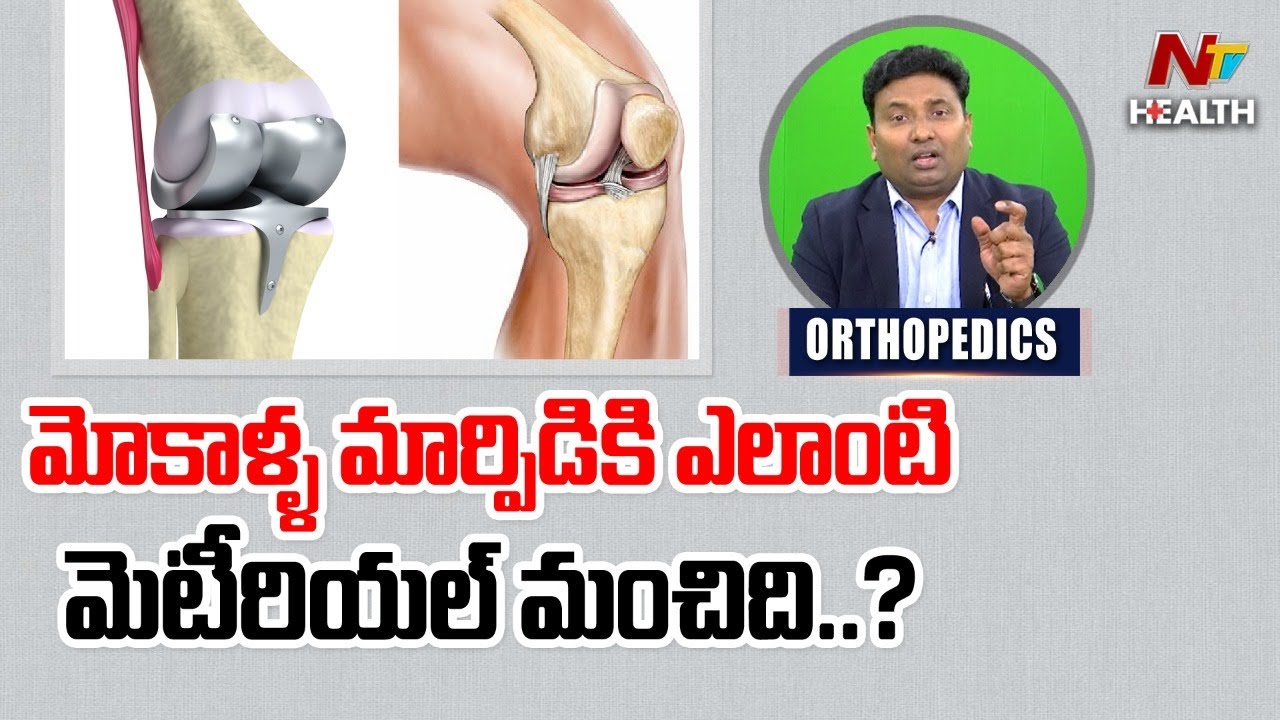 మోకాళ్ళ మార్పిడిలో ఎలాంటి మెటీరియల్ వాడతారు ..? | Dr. Sunil Dachepalli | Ntv Health Telugu