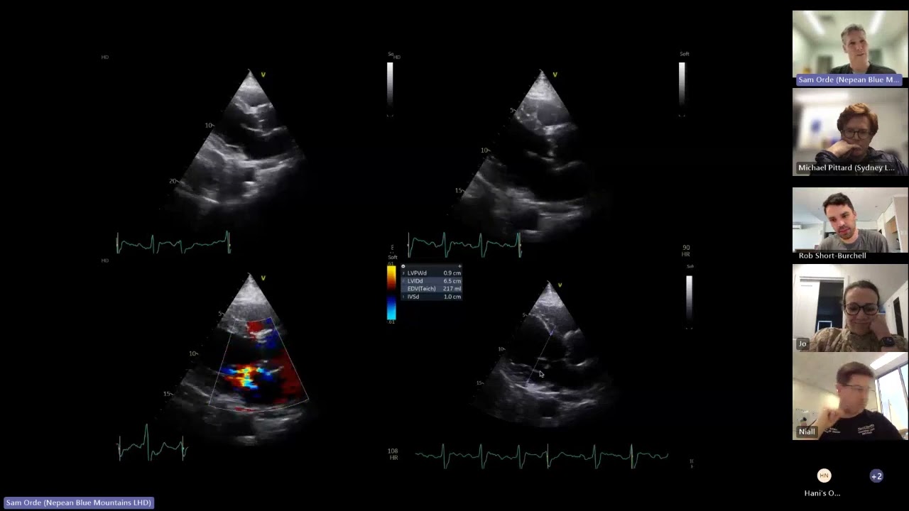 DDU Viva Cases - Part:1