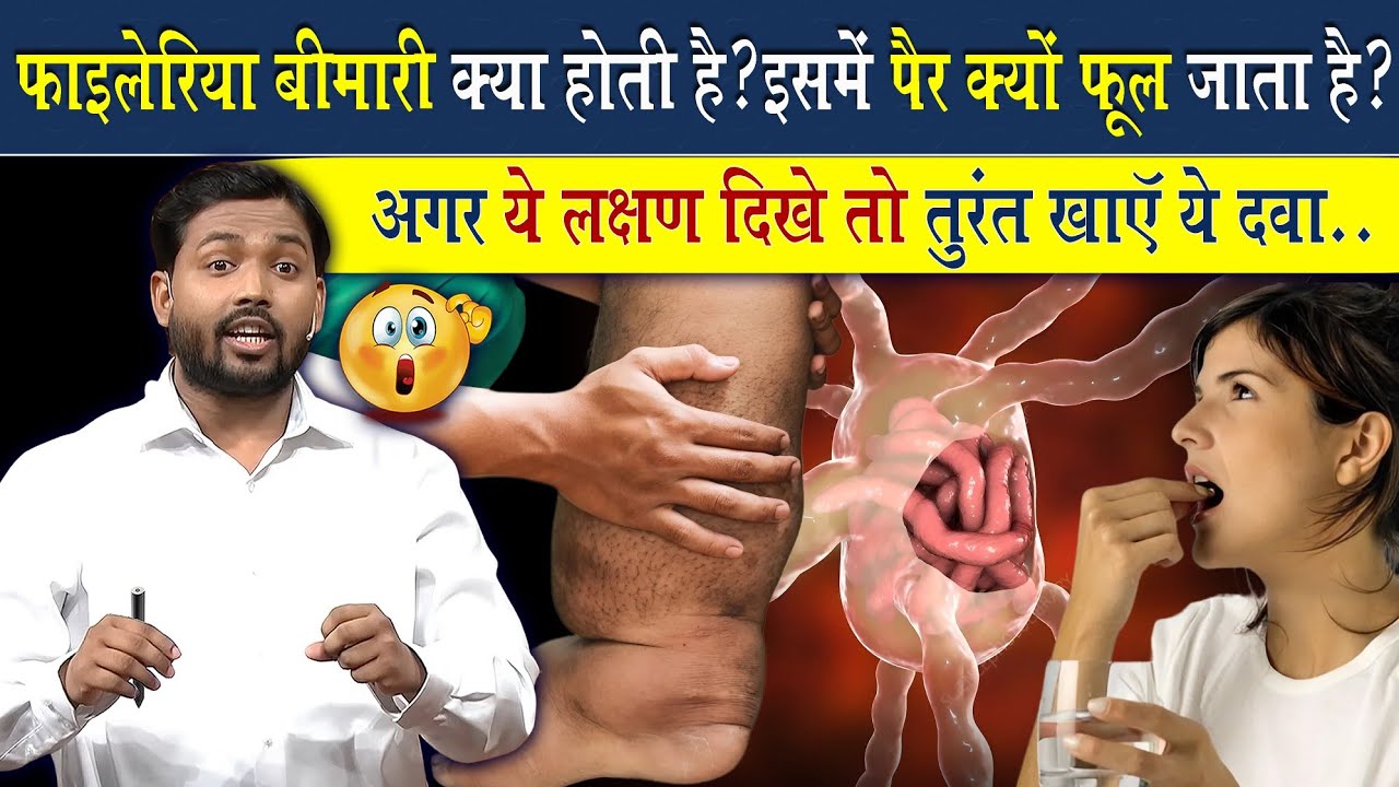 फाइलेरिया बीमारी क्या होती है? इसमें पैर क्यों फुल जाता है? @Viral_Khan_Sir