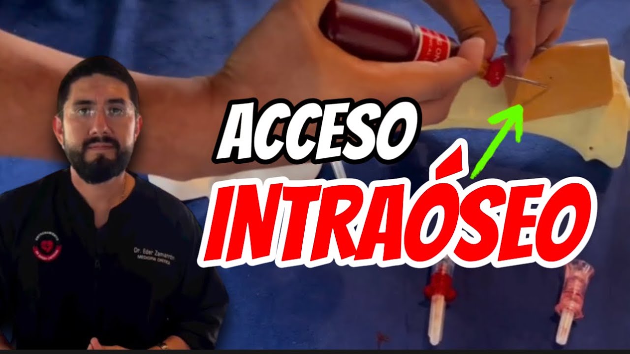 Cómo colócar un ACCESO INTRAÓSEO❓🤔 🦴| YO te enseño