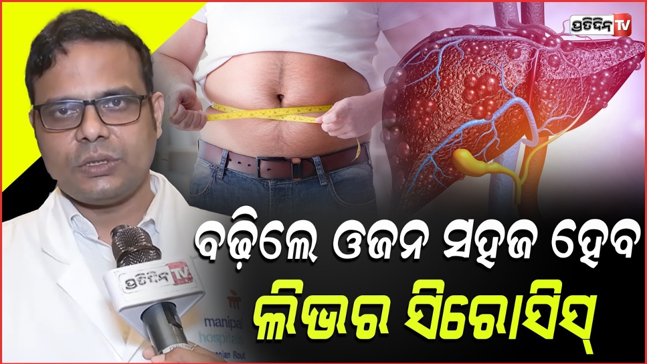 ବଢ଼ିଲେ ଓଜନ, ସହଜ ହେବ ଲିଭର ସିରୋସିସ୍ ! Manipal Hospital liver transplant treatment, bbsr