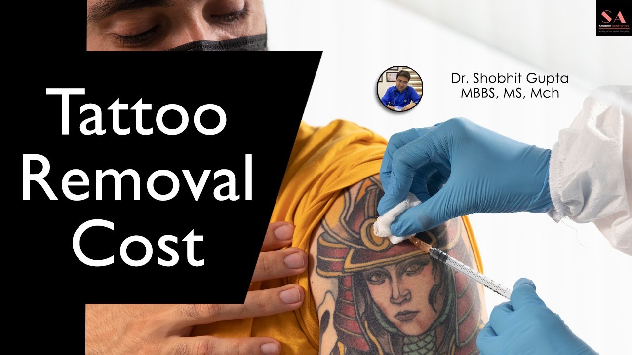 Tattoo Removal Cost in India | Laser Tattoo Removal Cost in Delhi | Technique | Shobhit Aesthetics