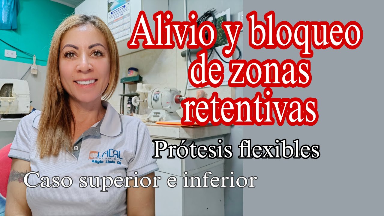 Alivio y bloqueo de zonas retentivas para prótesis flexible