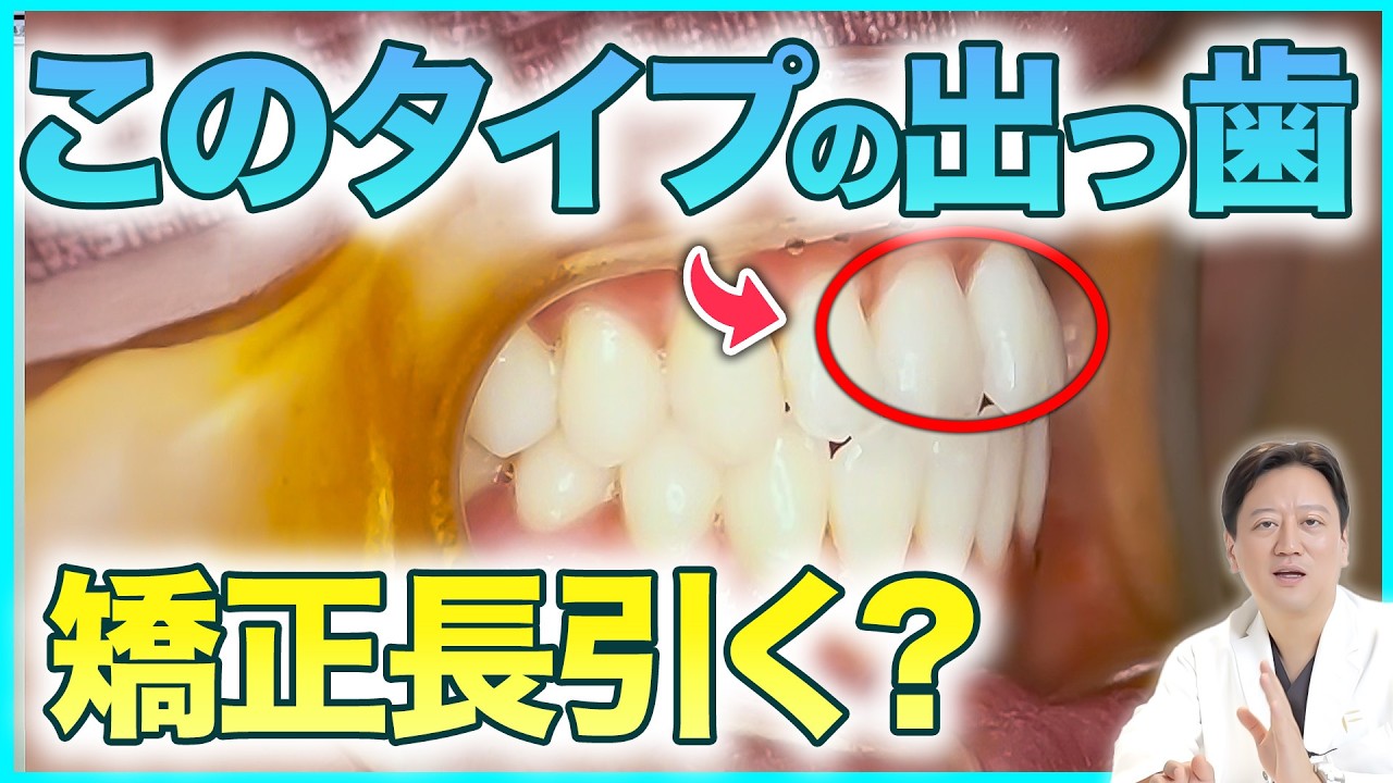 歯列矯正が早く終わる条件！ワイヤー矯正が長引かない人の共通点を徹底解説します【銀座 矯正 歯並び】