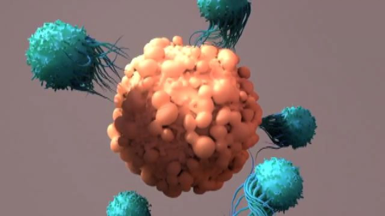 Nuova terapia per malattia di Waldenstrom, rara forma linfoma