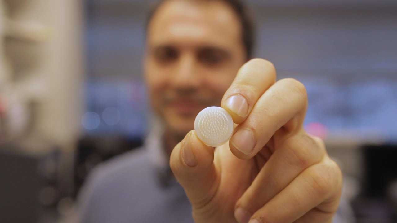 Using 3D-Printing to Stop Hair Loss