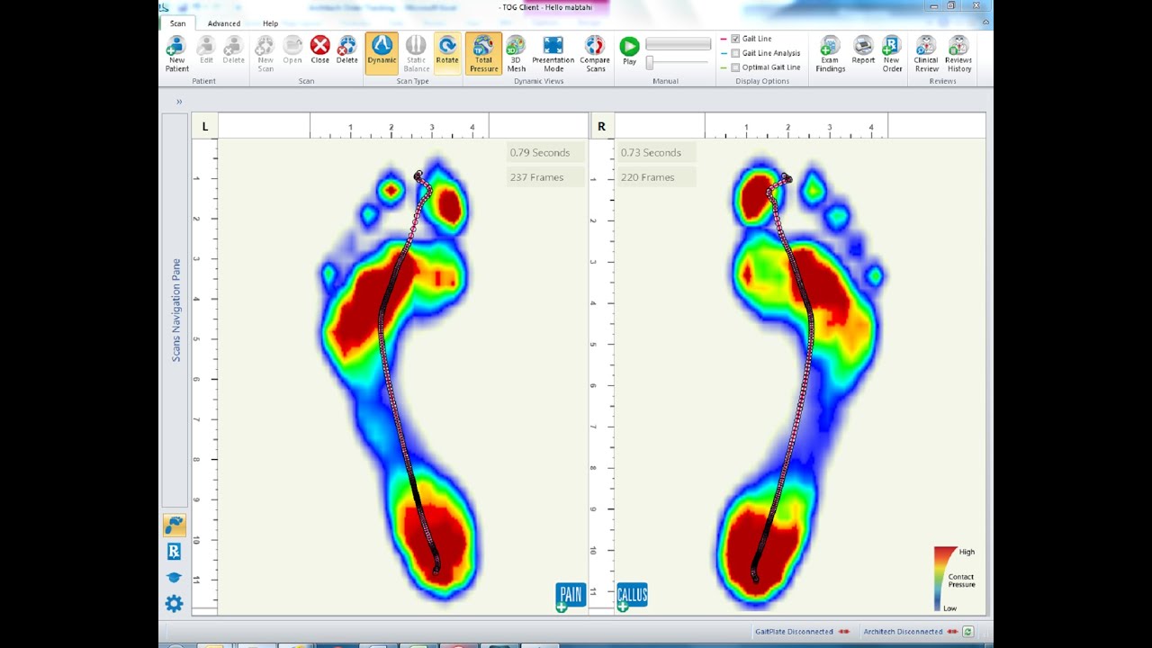 About GaitScan™ Foot Scanning Technology