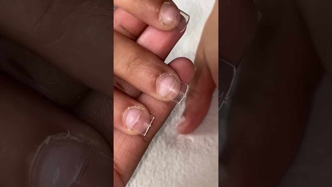 Nail Biting 😨