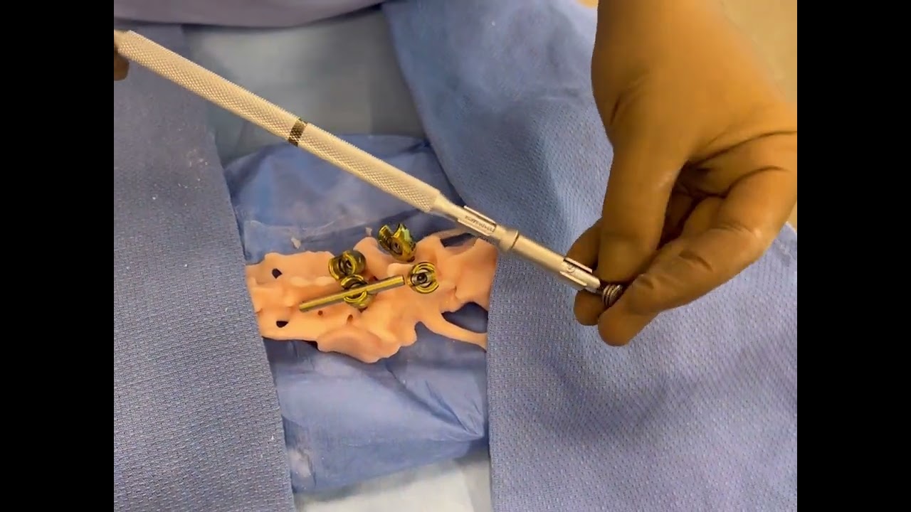 invetra pedicle screw placement