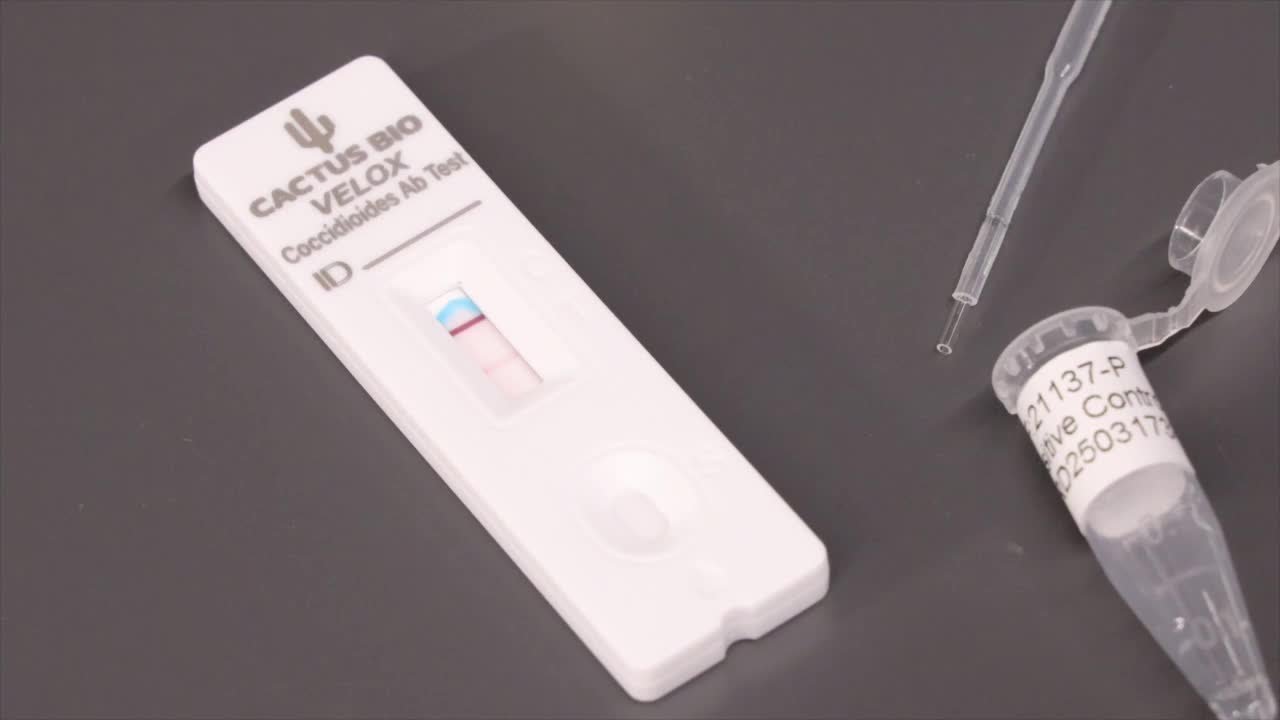 New rapid test for Valley Fever could revolutionize diagnosis in Arizona