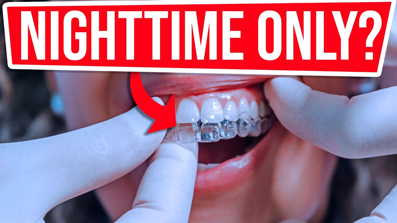 Отзыв ортодонта о Smile Direct Club — вариант только для ночного использования.