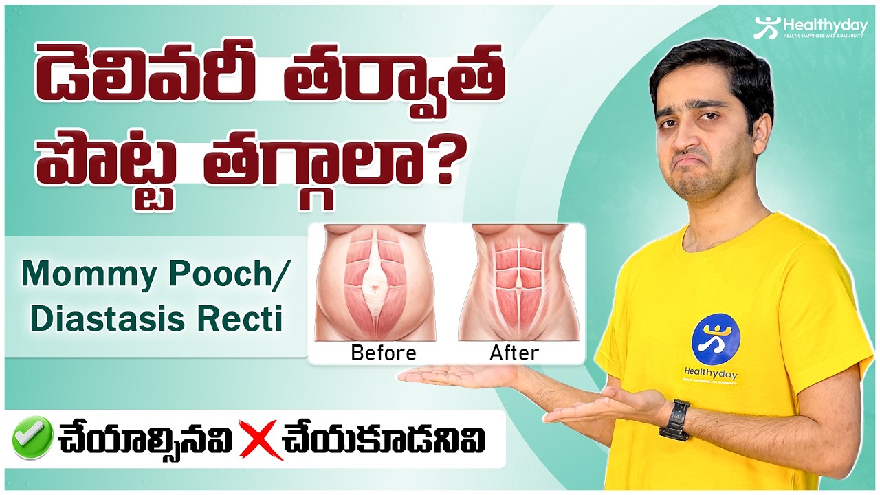 డెలివరీ తర్వాత పొట్ట తగ్గట్లేదా?| 5 Symptoms of Diastasis Recti | Mommy Pooch Fix