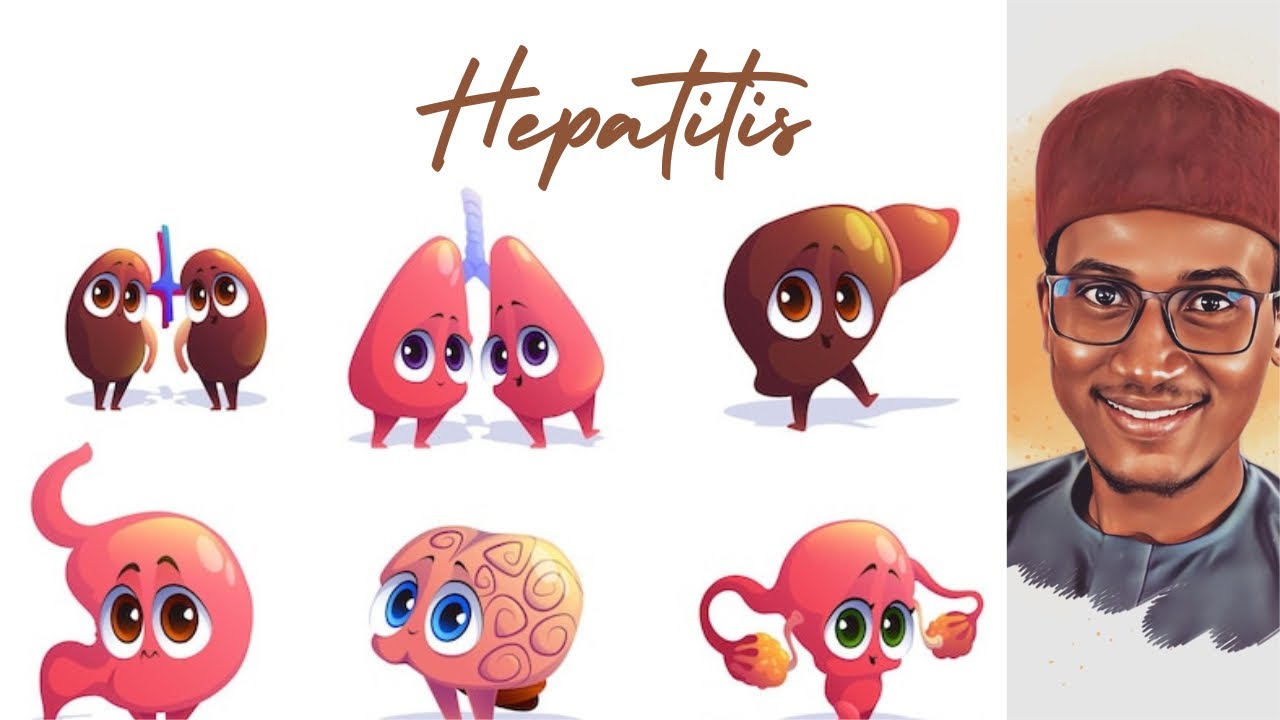 Hepatitis (Ciwon Kumburin Hanta)