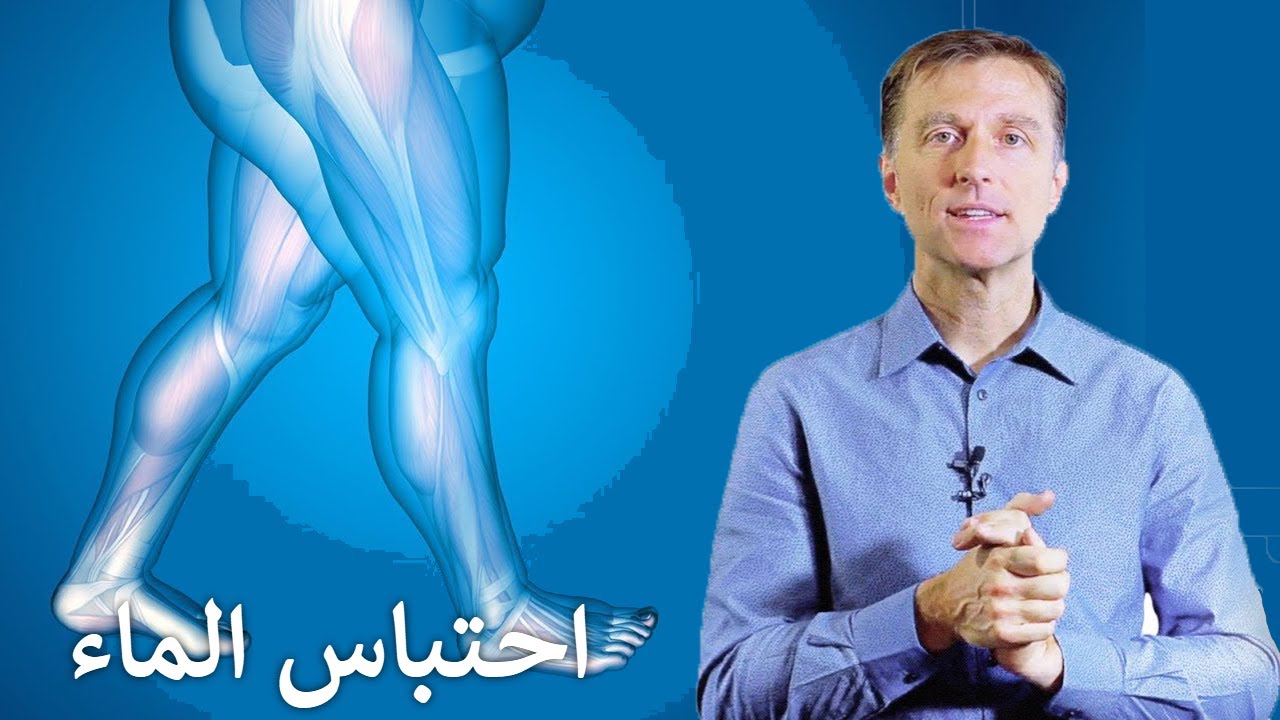 التخلص من احتباس الماء الزائد بالجسم بدون أدوية - اسبابه وعلاجه الفعال والسريع