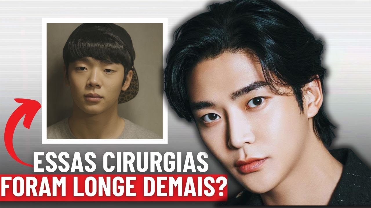 As Cirurgias Plásticas Mais EXTREMAS da História dos Doramas
