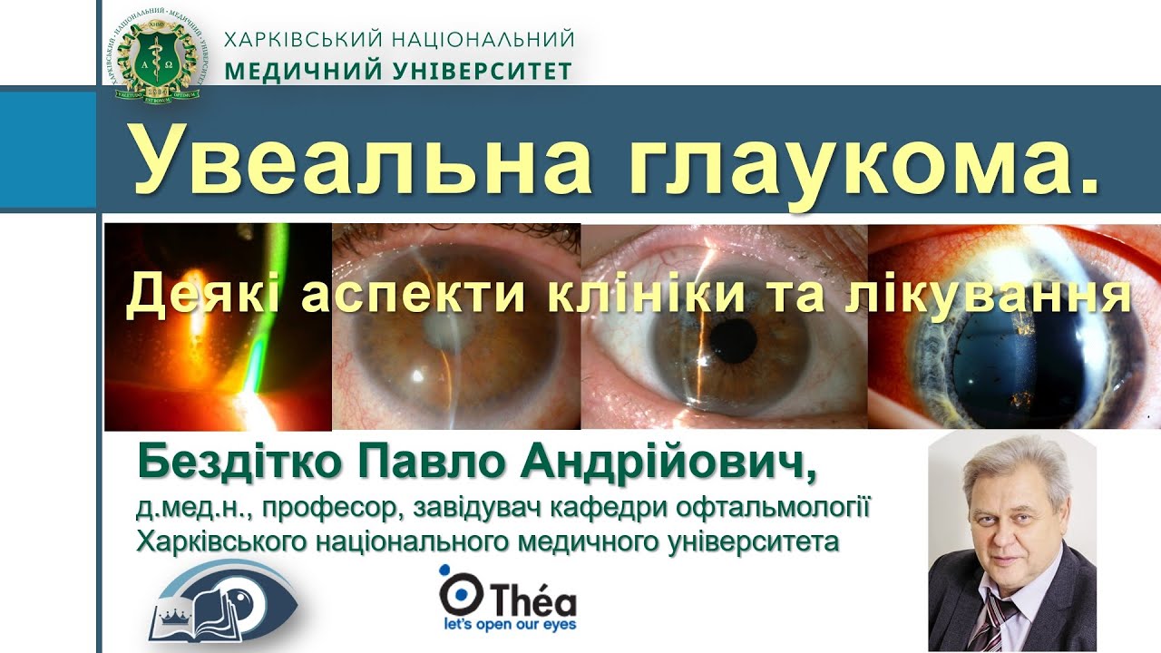 Увеальная глаукома. Некоторые аспекты клиники и лечения