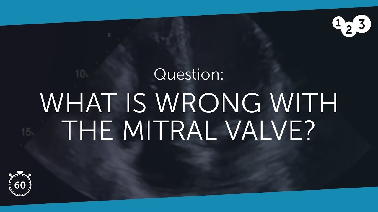 60 Seconds of Echo Teaching Question: What is wrong with the mitral valve?
