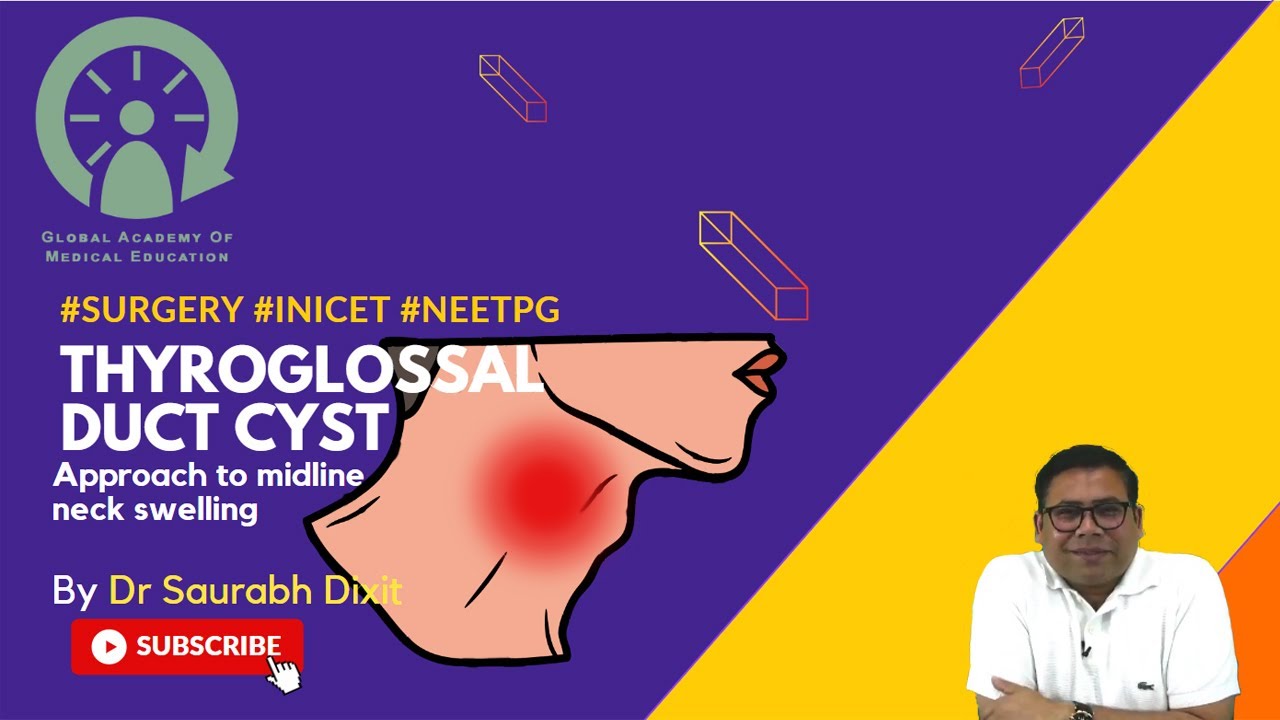 Thyroglossal duct cyst!!! Approach to midline neck swelling..