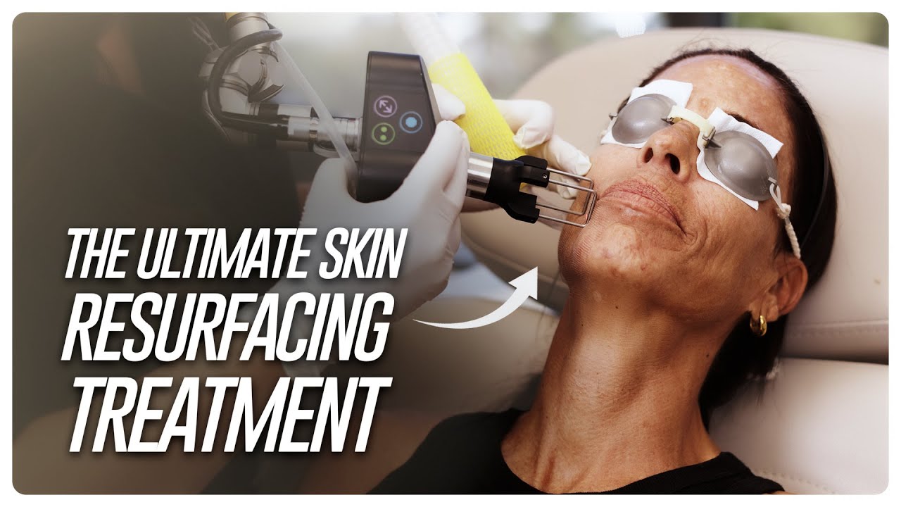 This Laser Completely Transforms Your Skin (Complete CO2 Explained)