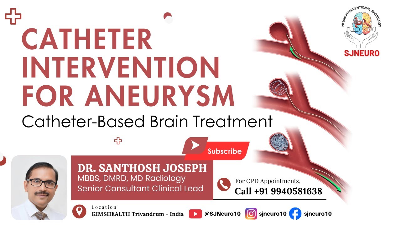 Catheter Intervention for Brain Aneurysm | Minimally Invasive Neuro Treatment Explained