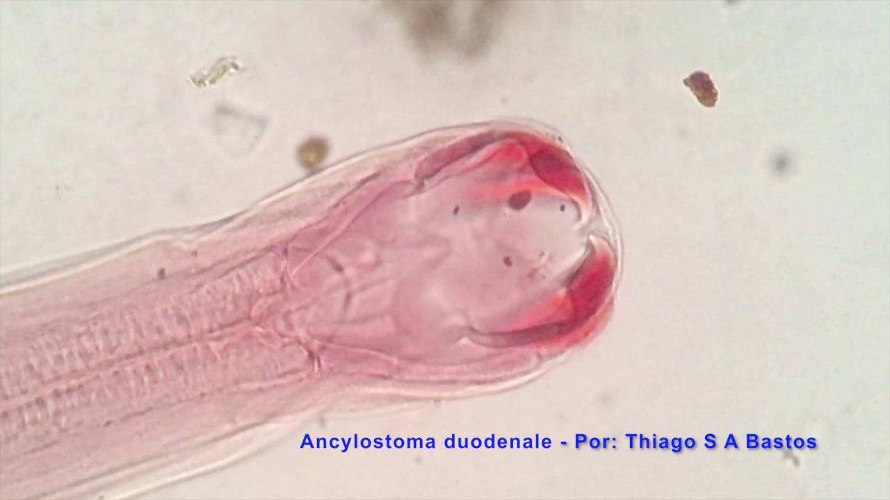 Ancylostoma duodenale ♂