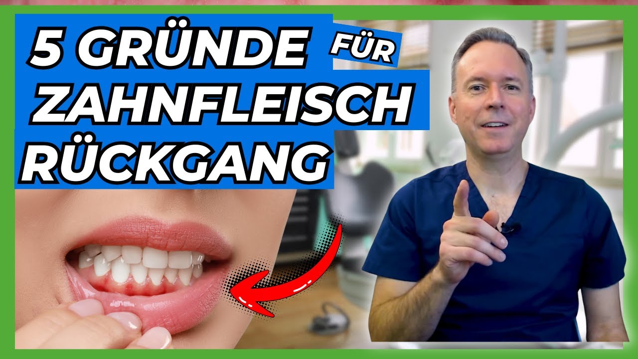 Zahnfleischrückgang: 5 Gründe, die du unbedingt kennen musst!