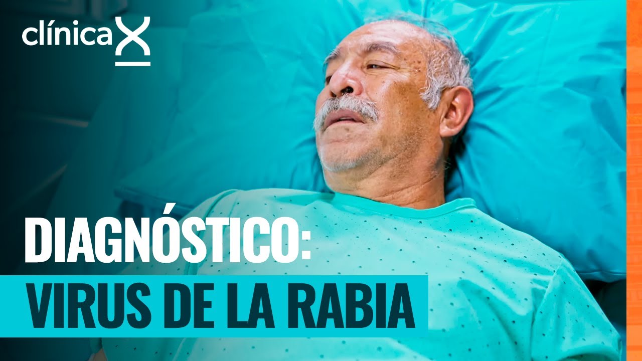 Antonio fue mordido por un animal y tiene el virus de la rabia | Clínica X