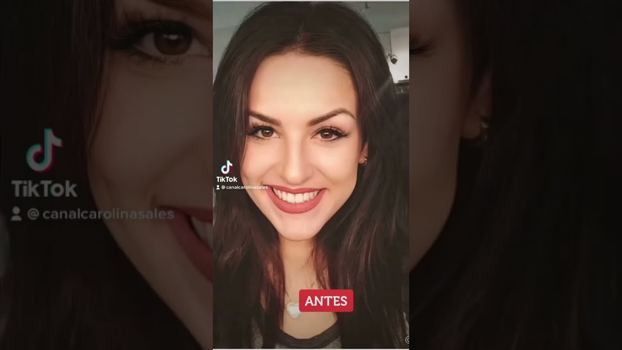 ANTES x DEPOIS: visual de K&eacute;fera