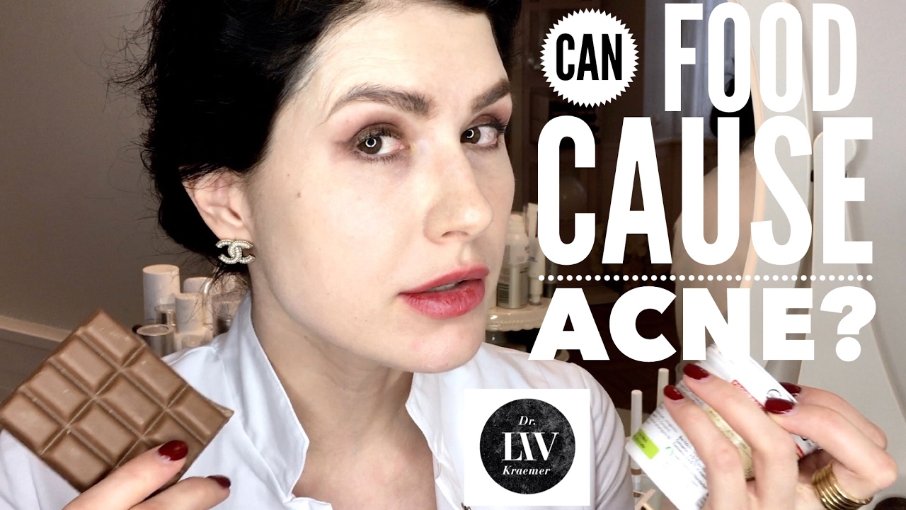 Food and acne connection - Is it a myth or a fact that food can cause acne? Dr. Liv explains
