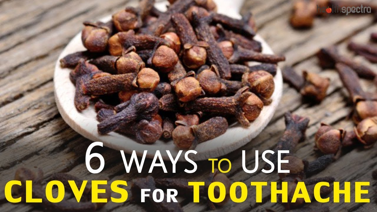 6 Ways to Use Cloves for Toothache