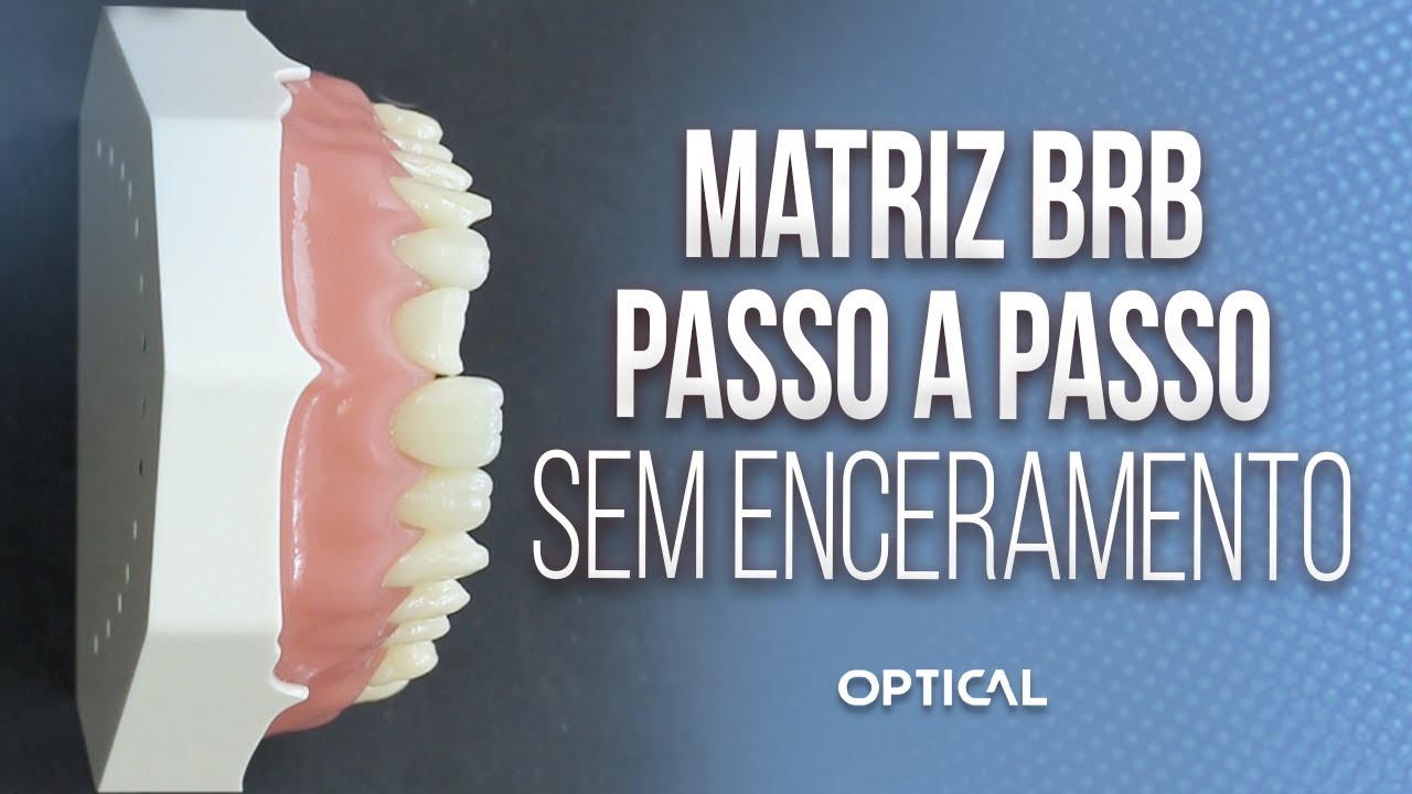 Como fazer a guia palatina sem enceramento