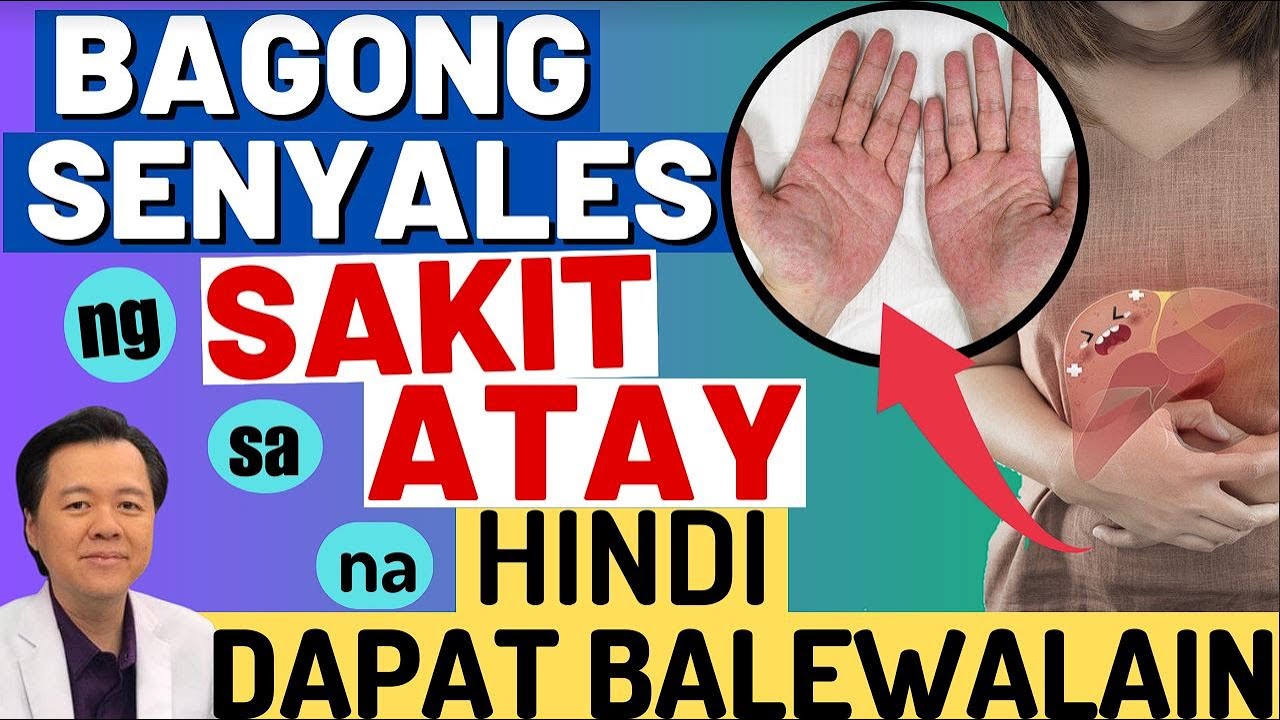 Bagong Senyales ng Sakit sa Atay na Hindi Dapat Balewalain - By Doc Willie Ong