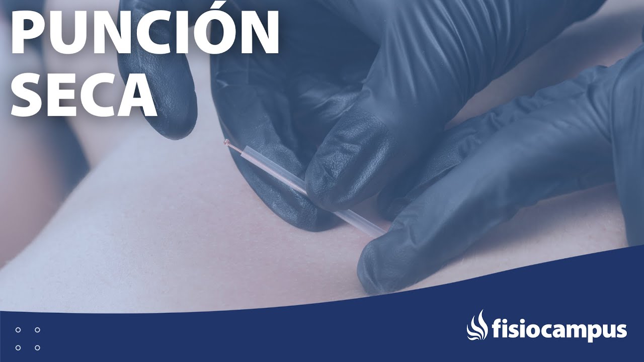 💪 PUNCIÓN SECA 💉 – PS para dolor lumbar y dorsal
