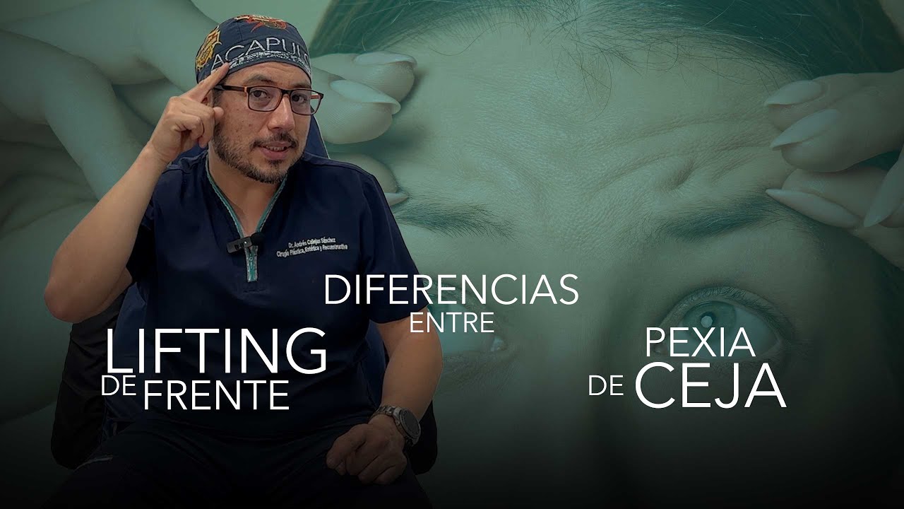 Diferencias entre el Lifting de Frente y Pexia de Ceja. ¿Cual es la ideal para ti?