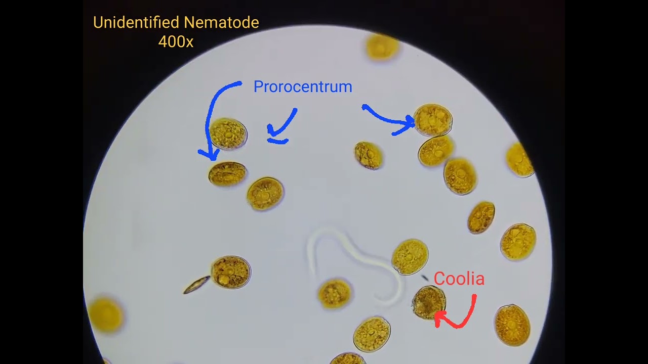 Unidentified Nematode, Coolia, and Prorocentrum in home salt water tank, 400x microscopy
