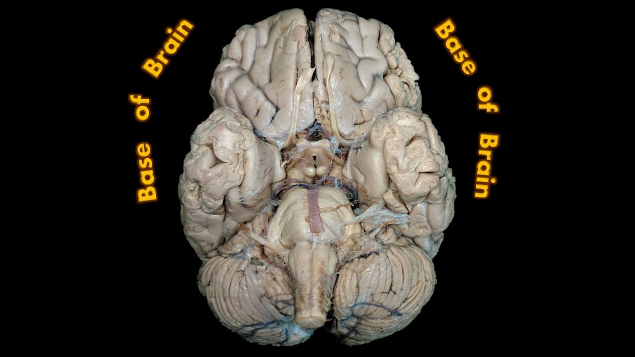 Base of Brain - Specimen Study