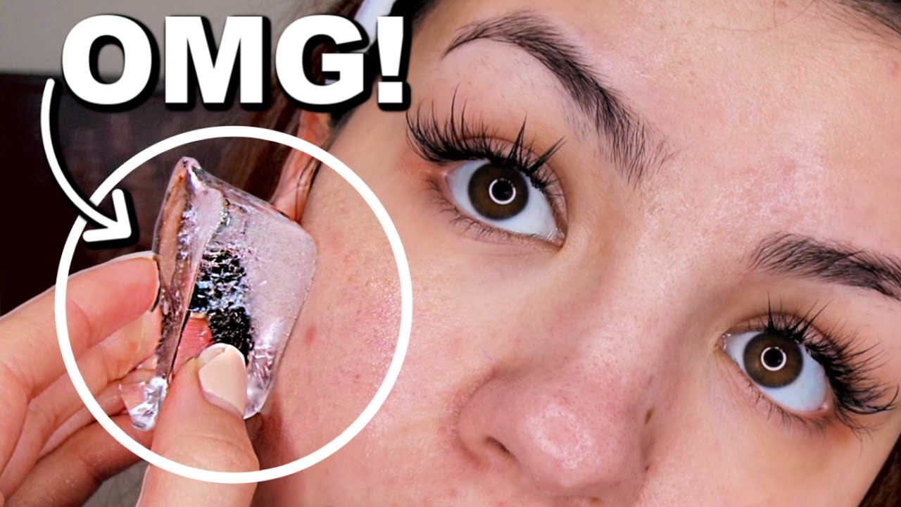I Rubbed An ICE CUBE On My Face Everyday For One Week...