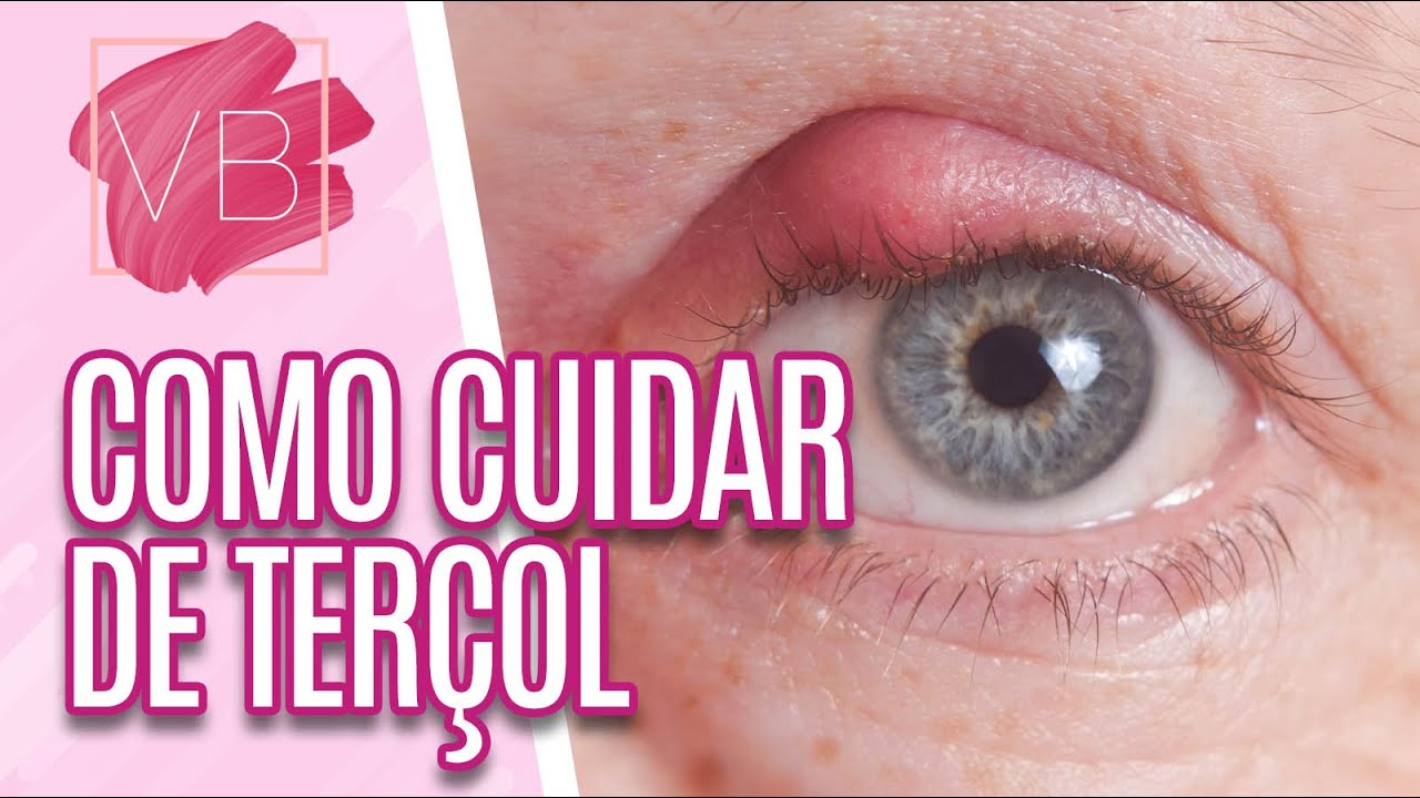 Saiba como cuidar do terçol - Você Bonita (14/01/21)