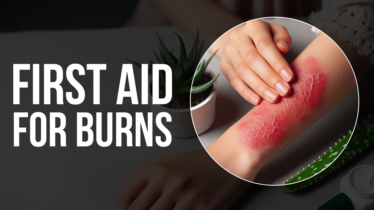 #ApolloHospitals | First Aid for Burns: Immediate Action Tips