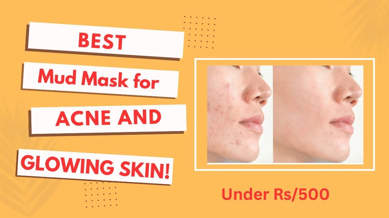 Mud Mask For Face | Get Glowing Skin & Acne Control Under Rs/500 | 🇵🇰 Summer Skincare Routine